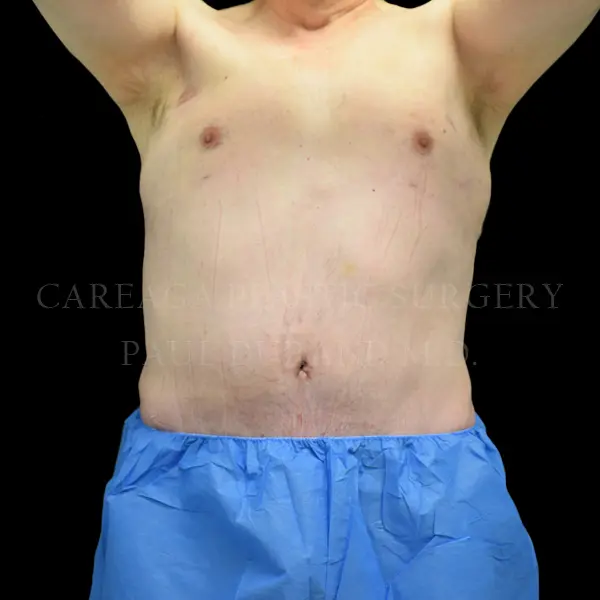 Daddy Makeover — after, actual Careaga patient
