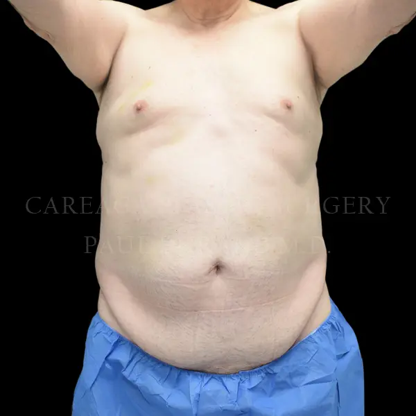 Daddy Makeover — before, actual Careaga patient